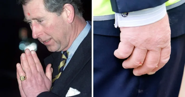 Prince Charles Hands: Understanding the Causes, Public Speculation, and Medical Insights prince charles hands
